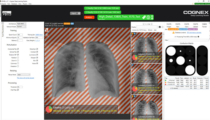VisionPro深度学习软件环境下的肺部cat扫描