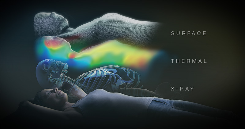 患者身体的表面、热成像和x射线成像