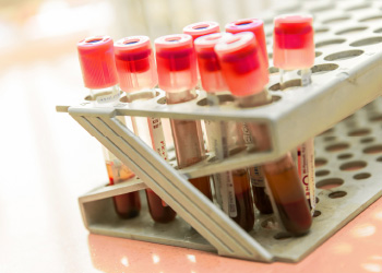 托盘中的血液样品瓶用于质量管理检验