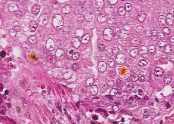 Cognex Cell Pathology