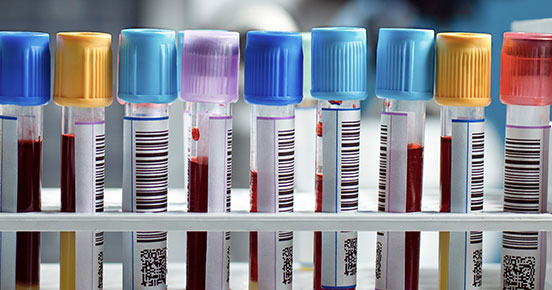 血瓶条形码生命科学的解决方案