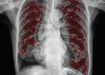 使用红色热图的x射线肺分割